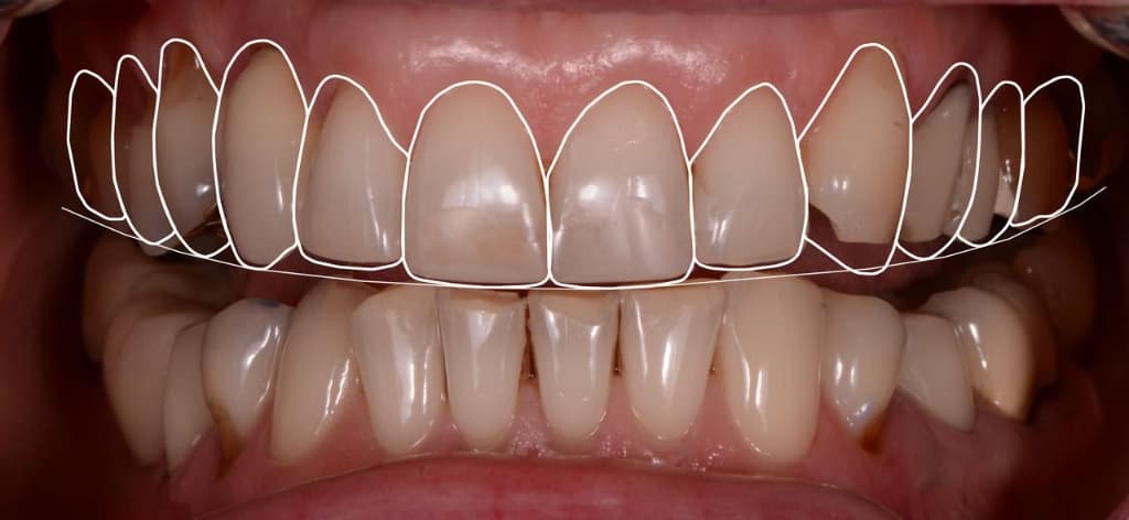 Smile Aesthetics